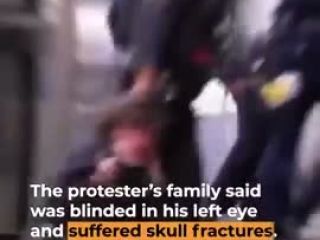 ICE shoots paintball guns under well-let outdoor stage