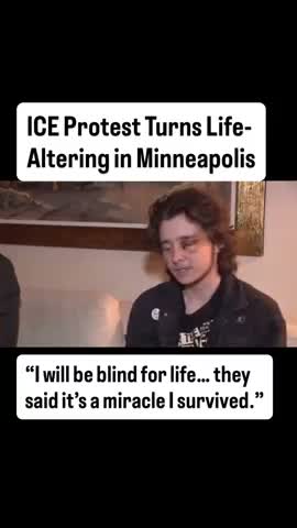 Kaden Rummler Has No Swelling In His Fake Injured Eye