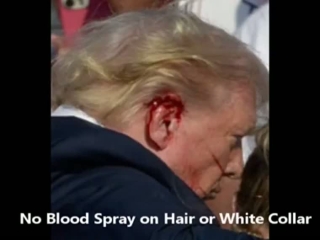 Trump's ear shot