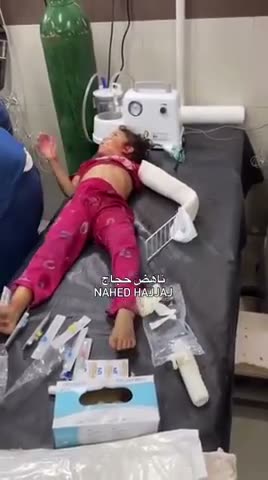 There are no real injuries in the fake wars