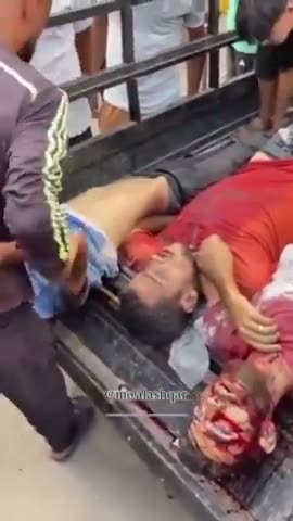 Dead Gazan bends, straighten legs