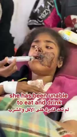 Pallywood monster gore, moulage makeup