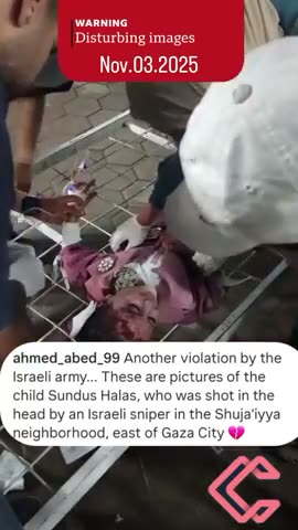 Girl shot in head but still smiling